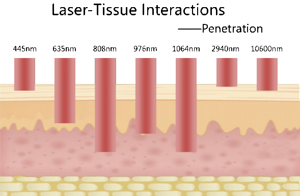 Laserbehandlung