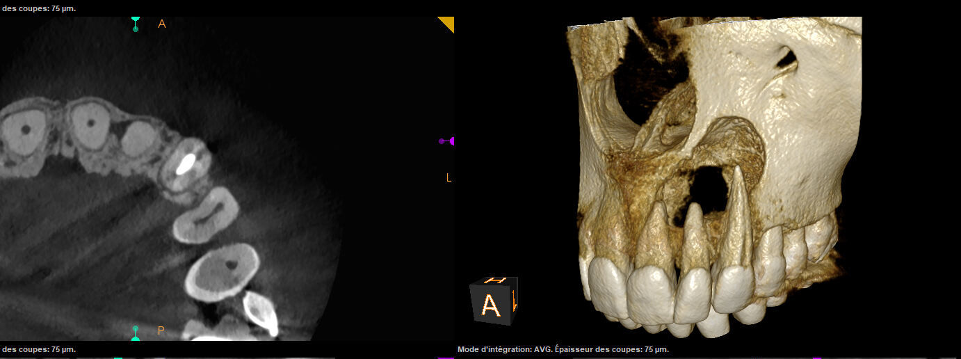 3D Roentgen