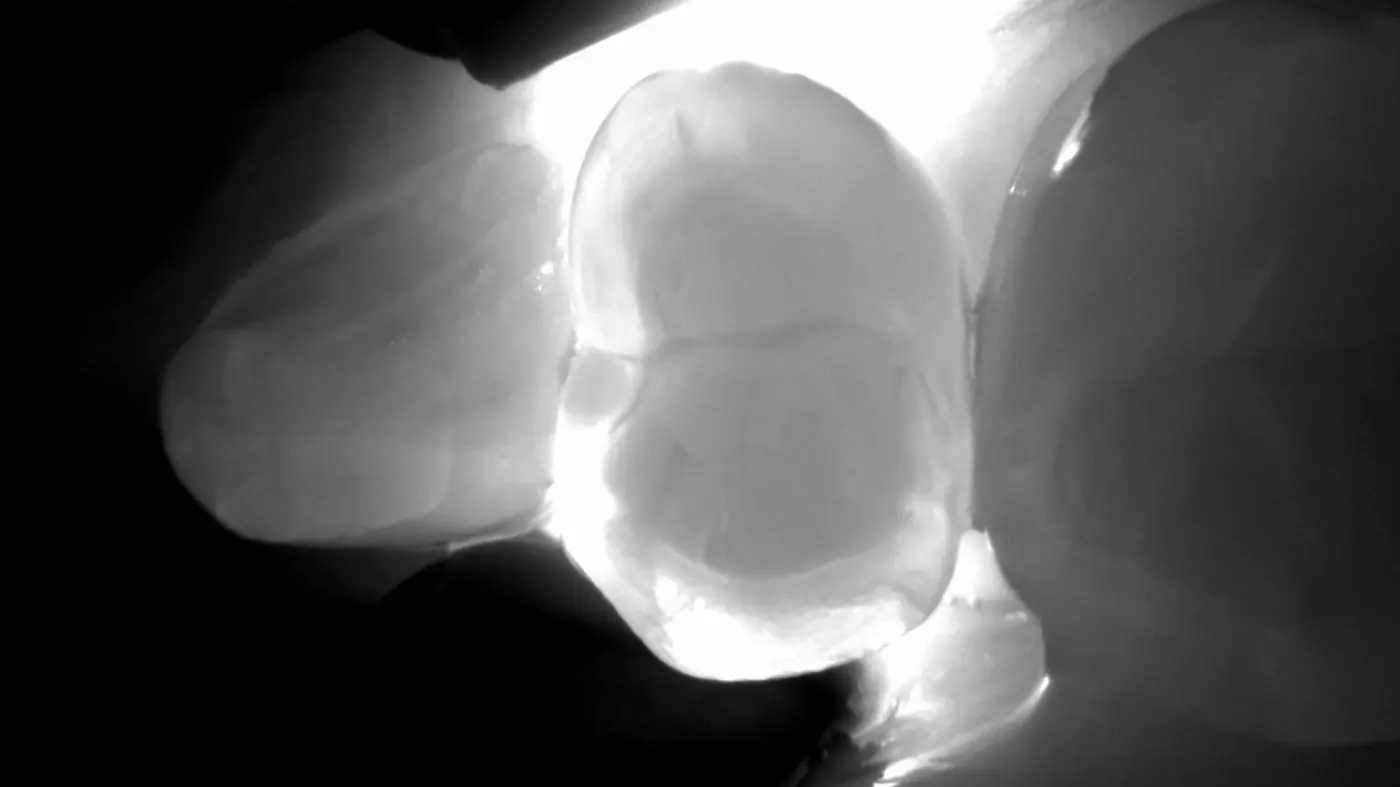 DIAGNOCAM Clinical 1 Transillu