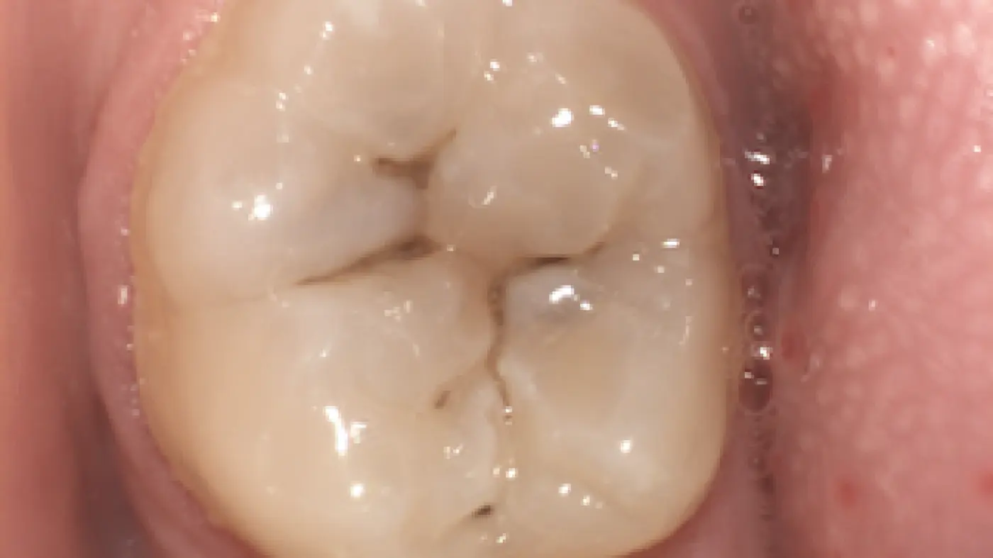 DIAGNOCAM Intraoralkamera
