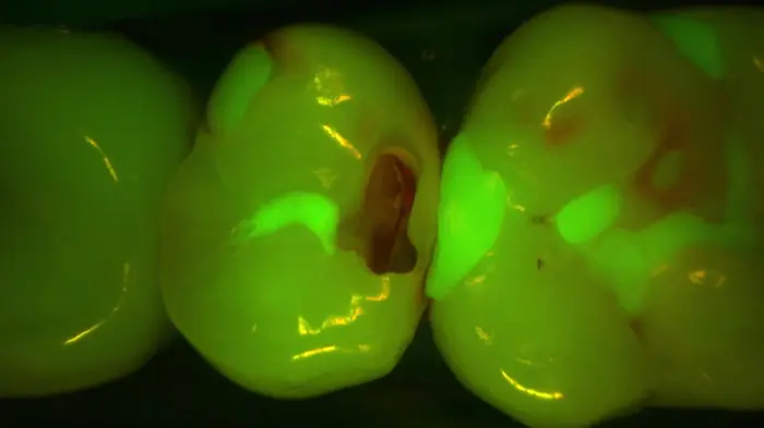 DIAGNOcam Vision Full HD Fluoreszenz2