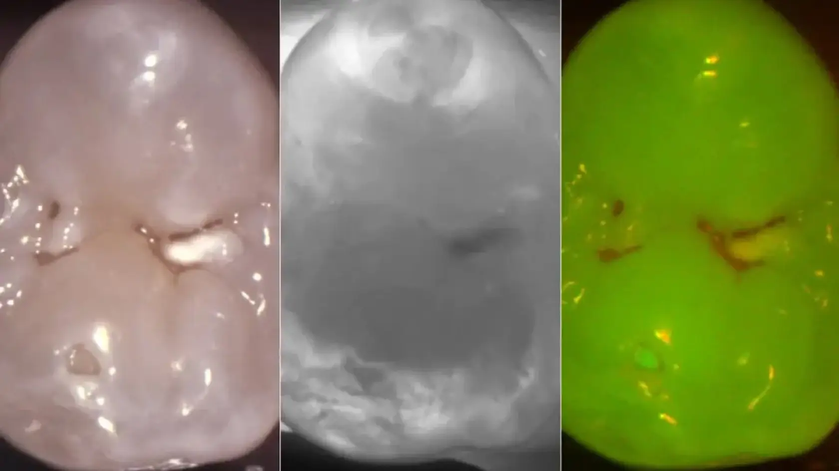 DIAGNOcam
