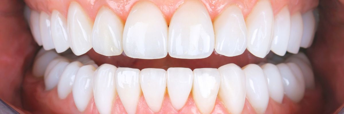 Header Ästhetische Zahnmedizin